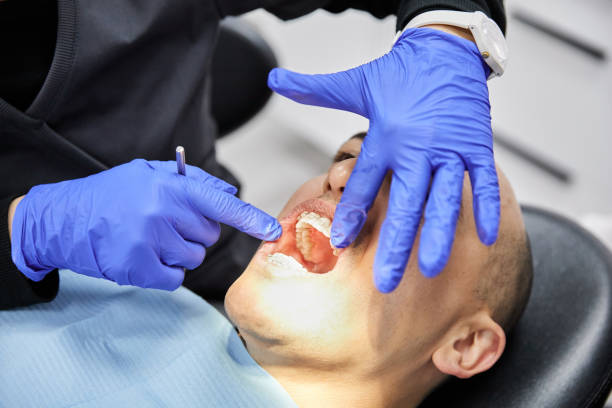 Best Urgent Care for Lost Fillings or Crowns in Chadds Ford, PA